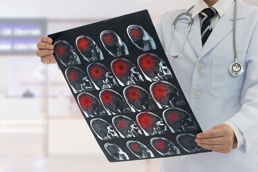 Arzt betrachtet Aufnahmen des Gehirns