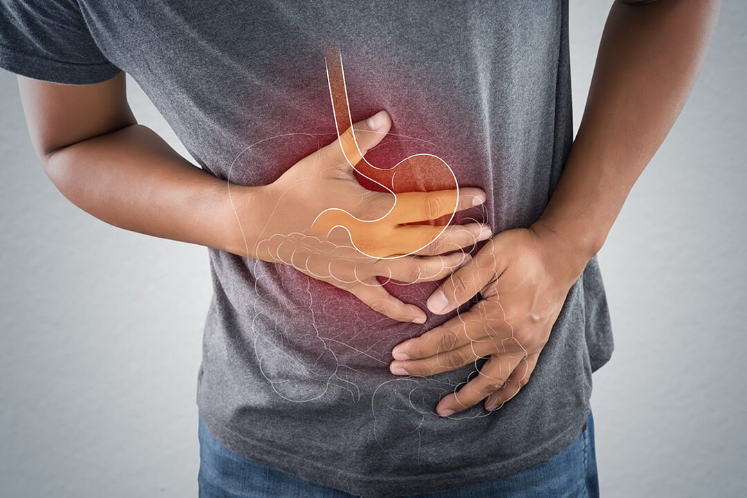 Problemas digestivos o intestinales relacionados con el Post-Covid